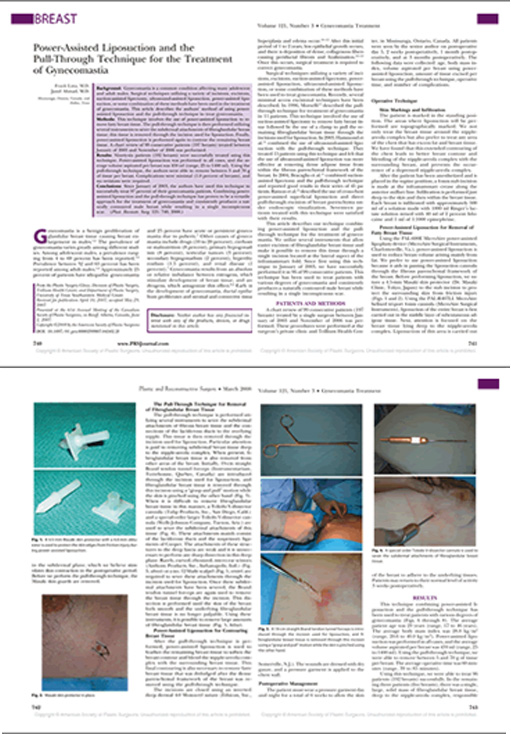 PRS(Plastic and Reconstructive Surgery) March2008,Volume121,issue3 に掲載