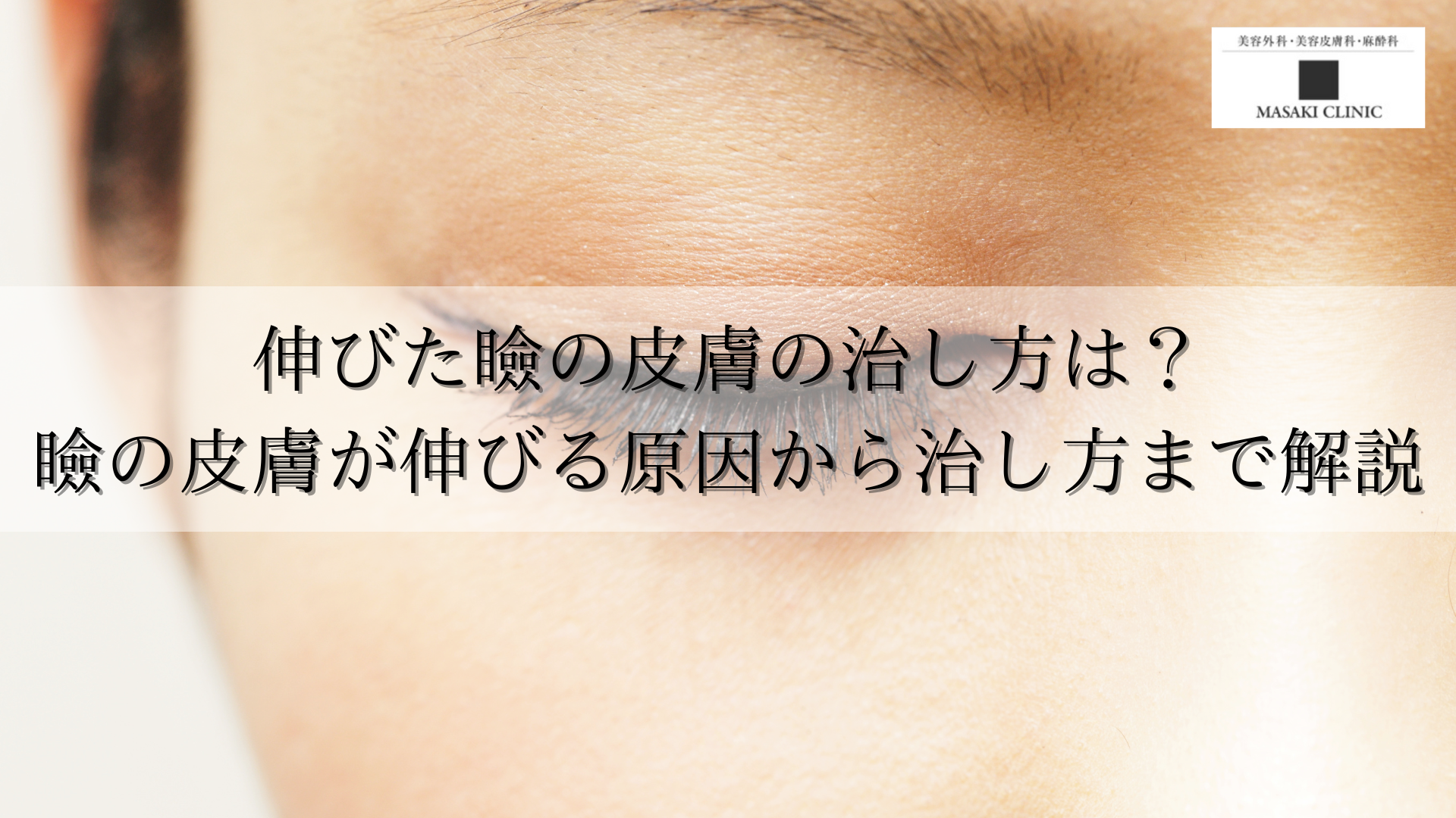 伸びた瞼の皮膚の治し方は？瞼の皮膚が伸びる原因から治し方まで解説